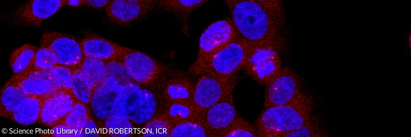 Mitosis, confocal light micrograph